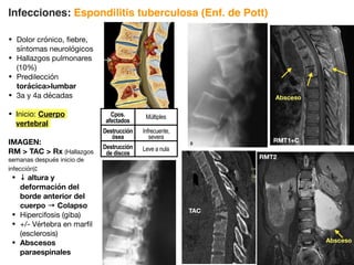 Infecciones: Espondilitis tuberculosa (Enf. de Pott)
• Dolor crónico, fiebre,
síntomas neurológicos
• Hallazgos pulmonares
(10%)
• Predilección
torácicalumbar
• 3a y 4a décadas
• Inicio: Cuerpo
vertebral
IMAGEN:
RM  TAC  Rx (Hallazgos
semanas después inicio de
infección):
• ↓ altura y
deformación del
borde anterior del
cuerpo → Colapso
• Hipercifosis (giba)
• +/- Vértebra en marfil
(esclerosis)
• Abscesos
paraespinales
Absceso
RMT1+C
RMT2
Absceso
578
(Left) Sagittal graphic through
lumbar spine depicts
multifocal granulomatous
osteomyelitis. Frank abscesses
are present at L3-L4 disc space
ﬅ and between spinous
process of L2 and L3 ﬆ.
(Right) Sagittal STIR MR in a
patient with TB infection
shows involvement of
contiguous vertebral bodies,
with subligamentous abscess
spread and partial disc
involvement ﬅ. Multiple focal
bone lesions are present
without adjacent disc
involvement ﬇.
(Left) Sagittal T1WI C+ FS MR
demonstrates focal kyphosis
at L2-L3, collapse of the disc
space, avid vertebral body
enhancement ﬅ, and ventral
and dorsal paravertebral
abscesses ﬆ. There are
peripherally enhancing
abscesses in the paraspinal
soft tissues ﬇, which exhibit
hypointense rims ﬊. (Right)
Coronal T1WI C+ FS MR shows
TB osteomyelitis with L2
vertebra plana ﬇. Psoas
involvement with swelling and
marked enhancement ﬅ is
present. Inflammatory soft
tissue surrounds the disc ﬈.
Cpos.
afectados
Múltiples
Destrucción
ósea
Infrecuente,
severa
Destrucción
de discos
Leve a nula
TAC
 