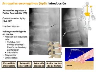 Espondilitis
anquilosante
Artropatía
enteropática
Artropatía
psoríasica
Artritis reactiva
(Sx de Reiter)
Artropatías seronegativas (ApS): Introducción
Artropatías negativas a
Factor Reumatoide (FR)
Correlación entre ApS y
HLA-B27
Hombres jóvenes
Hallazgos radiológicos
en común:
• Afección del esqueleto
axial
• Vértebra ‘con
bordes brillantes’:
Erosión de bordes y
proliferación
• Sacroileítis
• Oligoartritis
• Entesopatías
Hueso
Entesitis
 