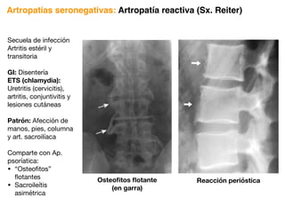 Secuela de infección
Artritis estéril y
transitoria
GI: Disentería
ETS (chlamydia):
Uretritis (cervicitis),
artritis, conjuntivitis y
lesiones cutáneas
Patrón: Afección de
manos, pies, columna
y art. sacroilíaca
Comparte con Ap.
psoríatica:
• “Osteofitos”
flotantes
• Sacroileítis
asimétrica
Artropatías seronegativas: Artropatía reactiva (Sx. Reiter)
Reacción perióstica
Osteofitos flotante
(en garra)
 