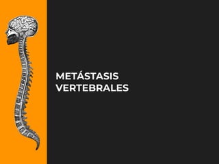 iDESIGN
by HiSlide.io
METÁSTASIS
VERTEBRALES
 