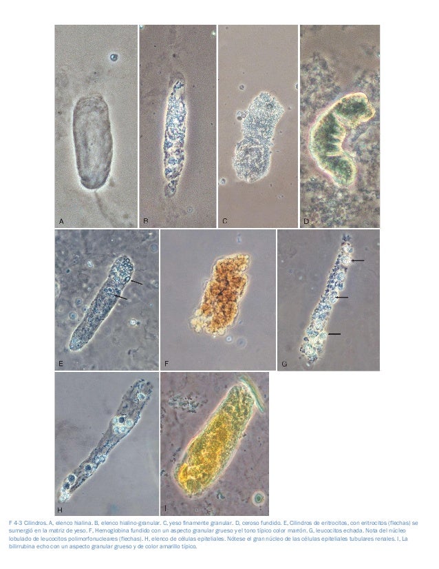 Cap 04 uroanalisis Comprehensive Clinical Nephrology
