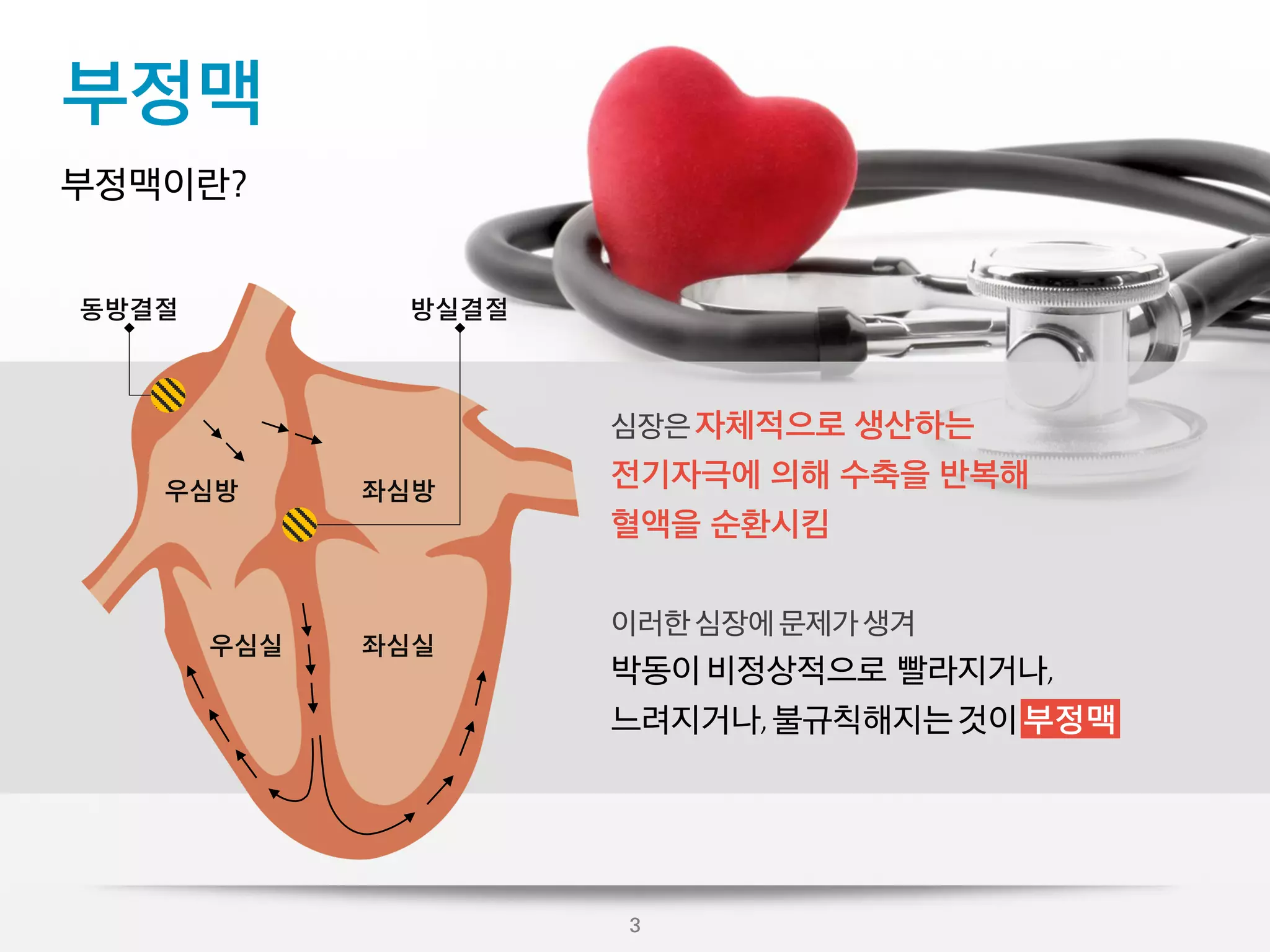심장질환   04 부정맥    