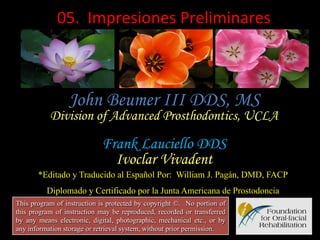  05.	
  	
  Impresiones	
  Preliminares	
  

John Beumer III DDS, MS

Division of Advanced Prosthodontics, UCLA

Frank Lauciello DDS
Ivoclar Vivadent
*Editado y Traducido al Español Por: William J. Pagán, DMD, FACP
Diplomado y Certificado por la Junta Americana de Prostodoncia
This program of instruction is protected by copyright ©. No portion of
this program of instruction may be reproduced, recorded or transferred
by any means electronic, digital, photographic, mechanical etc., or by
any information storage or retrieval system, without prior permission.

 