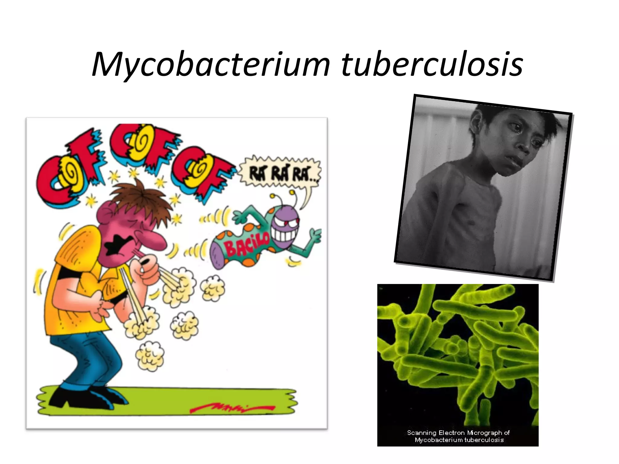 Mycobacterium tuberculosis
ME
 