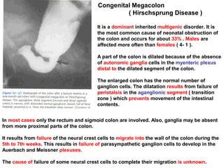 Congenital Megacolon
( Hirschsprung Disease )
It is a dominant inherited multigenic disorder. It is
the most common cause of neonatal obstruction of
the colon and occurs for about 33% . Males are
affected more often than females ( 4- 1 ).
A part of the colon is dilated because of the absence
of autonomic ganglia cells in the myenteric plexus
distal to the dilated segment of the colon.
The enlarged colon has the normal number of
ganglion cells. The dilatation results from failure of
peristalsis in the aganglionic segment ( transition
zone ) which prevents movement of the intestinal
contents.
In most cases only the rectum and sigmoid colon are involved. Also, ganglia may be absent
from more proximal parts of the colon.
It results from failure of the neural crest cells to migrate into the wall of the colon during the
5th to 7th weeks. This results in failure of parasympathetic ganglion cells to develop in the
Auerbach and Meissner plexuses.
The cause of failure of some neural crest cells to complete their migration is unknown.
 