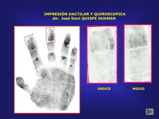 IMPRESIÓN DACTILAR Y QUIROSCOPICA
de: José Dani QUISPE HUAMAN
INDICE MEDIO
 