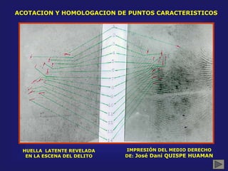 ACOTACION Y HOMOLOGACION DE PUNTOS CARACTERISTICOS
HUELLA LATENTE REVELADA
EN LA ESCENA DEL DELITO
IMPRESIÓN DEL MEDIO DERECHO
DE: José Dani QUISPE HUAMAN
 