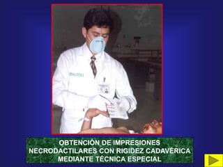 OBTENCIÓN DE IMPRESIONES
NECRODACTILARES CON RIGIDEZ CADAVÉRICA
MEDIANTE TÉCNICA ESPECIAL
 
