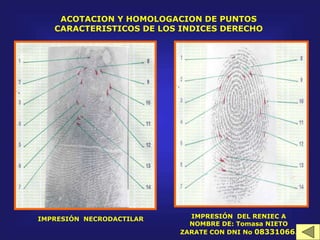 ACOTACION Y HOMOLOGACION DE PUNTOS
CARACTERISTICOS DE LOS INDICES DERECHO
IMPRESIÓN NECRODACTILAR IMPRESIÓN DEL RENIEC A
NOMBRE DE: Tomasa NIETO
ZARATE CON DNI No 08331066.
 