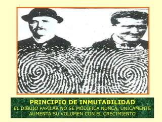 PRINCIPIO DE INMUTABILIDAD
EL DIBUJO PAPILAR NO SE MODIFICA NUNCA, UNICAMENTE
AUMENTA SU VOLUMEN CON EL CRECIMIENTO
 