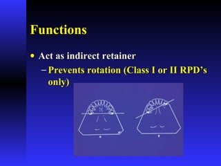 FunctionsFunctions
• Act as indirect retainerAct as indirect retainer
− Prevents rotation (Class I or II RPD’sPrevents rotation (Class I or II RPD’s
only)only)
 