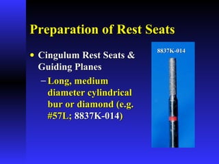 Preparation of Rest SeatsPreparation of Rest Seats
• Cingulum Rest Seats &Cingulum Rest Seats &
Guiding PlanesGuiding Planes
− Long, mediumLong, medium
diameter cylindricaldiameter cylindrical
bur or diamond (e.g.bur or diamond (e.g.
#57L;#57L; 8837K-0148837K-014))
8837K-0148837K-014
 