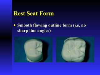 Rest Seat FormRest Seat Form
• Smooth flowing outline form (i.e. noSmooth flowing outline form (i.e. no
sharp line angles)sharp line angles)
 