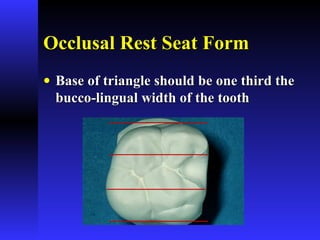 Occlusal Rest Seat FormOcclusal Rest Seat Form
• Base of triangle should be one third theBase of triangle should be one third the
bucco-lingual width of the toothbucco-lingual width of the tooth
 