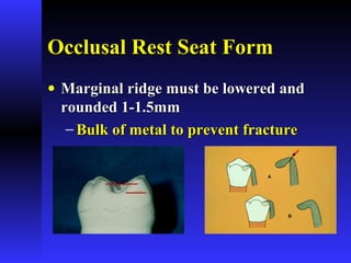 Occlusal Rest Seat FormOcclusal Rest Seat Form
• Marginal ridge must be lowered andMarginal ridge must be lowered and
rounded 1-1.5mmrounded 1-1.5mm
− Bulk of metal to prevent fractureBulk of metal to prevent fracture
 