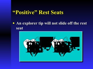 ““Positive” Rest SeatsPositive” Rest Seats
• An explorer tip will not slide off the restAn explorer tip will not slide off the rest
seatseat
ExplorerwillNOTslipoffrestseatifpulledproximallly ExplorerWILLslipoffrestseatifpulledproximallly‘Positive’RestSeat(<90°) RestSeatnot‘Positive’(>90°)
 