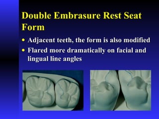 Double Embrasure Rest SeatDouble Embrasure Rest Seat
FormForm
• Adjacent teeth, the form is also modifiedAdjacent teeth, the form is also modified
• Flared more dramatically on facial andFlared more dramatically on facial and
lingual line angleslingual line angles
 