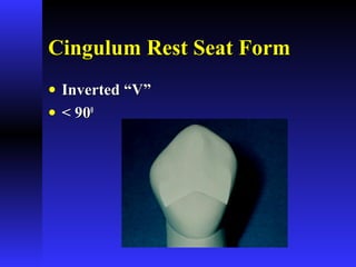 Cingulum Rest Seat FormCingulum Rest Seat Form
• Inverted “V”Inverted “V”
• < 90< 9000
 