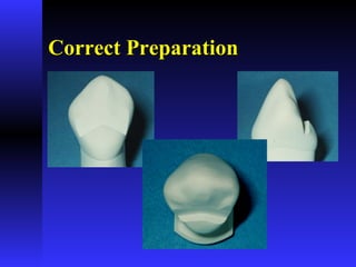 Correct PreparationCorrect Preparation
 