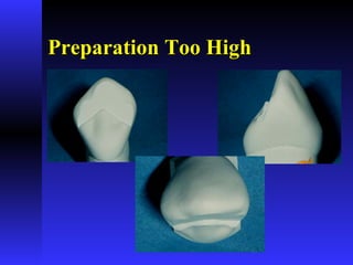 Preparation Too HighPreparation Too High
 