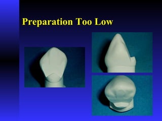 Preparation Too LowPreparation Too Low
 