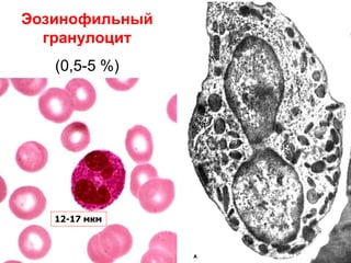 Эозинофильный
гранулоцит
(0,5-5 %)
12-17 мкм
 