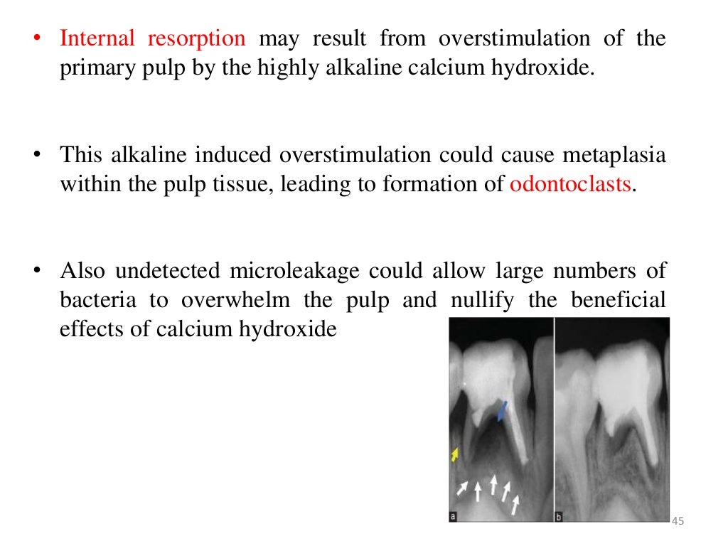 05.dental cements
