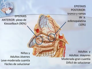 Niños y
Adultos Jóvenes
Leve-moderada cuantía
Fáciles de solucionar
Adultos y
Adultos mayores
Moderada-gran cuantía
Difícil de solucionar
EPISTAXIS
ANTERIOR: plexo de
Kiesselbach (90%)
EPISTAXIS
POSTERIOR:
tronco y ramas
de a.
esfenopalatina
(10%)
 