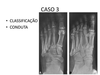 CASO 3
• CLASSIFICAÇÃO
• CONDUTA
 