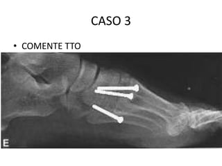 CASO 3
• COMENTE TTO
 