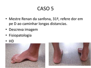 CASO 5
• Mestre Renan da sanfona, 31ª, refere dor em
pe D ao caminhar longas distancias.
• Descreva imagem
• Fisiopatologia
• HD
 