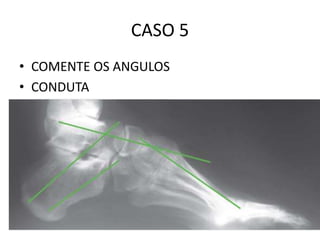 CASO 5
• COMENTE OS ANGULOS
• CONDUTA
 