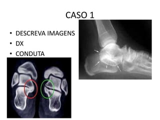 CASO 1
• DESCREVA IMAGENS
• DX
• CONDUTA
 
