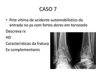 CASO 7
• Pcte vitima de acidente automobilistico da
entrada no ps com fortes dores em tornozelo
Descreva rx
HD
Caracteristicas da fratura
Ex complementares
 