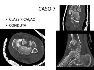 CASO 7
• CLASSIFICAÇAO
• CONDUTA
 