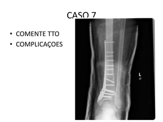 CASO 7
• COMENTE TTO
• COMPLICAÇOES
 