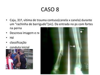 CASO 8
• Caju, 31ª, vitima de trauma contuso(canela x canela) durante
um “rachinha de barrigudo”(sic). Da entrada no ps com fortes
na perna
• Descreva imagem e rx
• Hd
• classificação
• conduta inicial
 