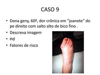 CASO 9
• Dona geny, 60ª, dor crônica em “joanete” do
pe direito com salto alto de bico fino .
• Descreva imagem
• Hd
• Fatores de risco
 