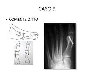 CASO 9
• COMENTE O TTO
 