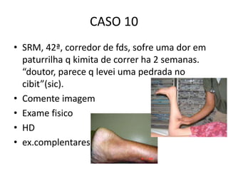 CASO 10
• SRM, 42ª, corredor de fds, sofre uma dor em
paturrilha q kimita de correr ha 2 semanas.
“doutor, parece q levei uma pedrada no
cibit”(sic).
• Comente imagem
• Exame fisico
• HD
• ex.complentares
 