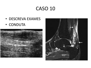 CASO 10
• DESCREVA EXAMES
• CONDUTA
 