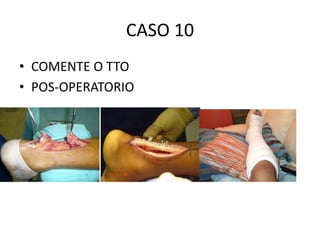 CASO 10
• COMENTE O TTO
• POS-OPERATORIO
 