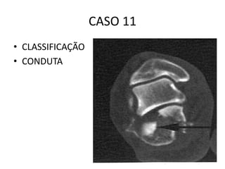 CASO 11
• CLASSIFICAÇÃO
• CONDUTA
 