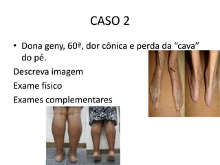 CASO 2
• Dona geny, 60ª, dor cônica e perda da “cava”
do pé.
Descreva imagem
Exame fisico
Exames complementares
 