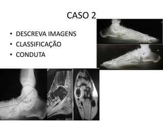 CASO 2
• DESCREVA IMAGENS
• CLASSIFICAÇÃO
• CONDUTA
 
