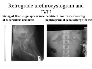 Comprehensive Radiodiagnosis Of The Urinary System Anatomy Pathology comprehensive-radiodiagnosis-of-the-urinary-system-anatomy-pathology