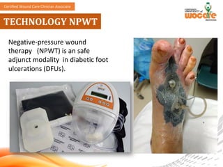 Comprehensive Multidisciplinary Approach to Diabetic Foot Ulcer Care ...