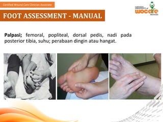 Comprehensive Multidisciplinary Approach to Diabetic Foot Ulcer Care ...