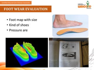 Comprehensive Multidisciplinary Approach to Diabetic Foot Ulcer Care ...