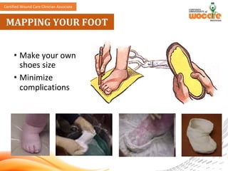 Comprehensive Multidisciplinary Approach to Diabetic Foot Ulcer Care ...